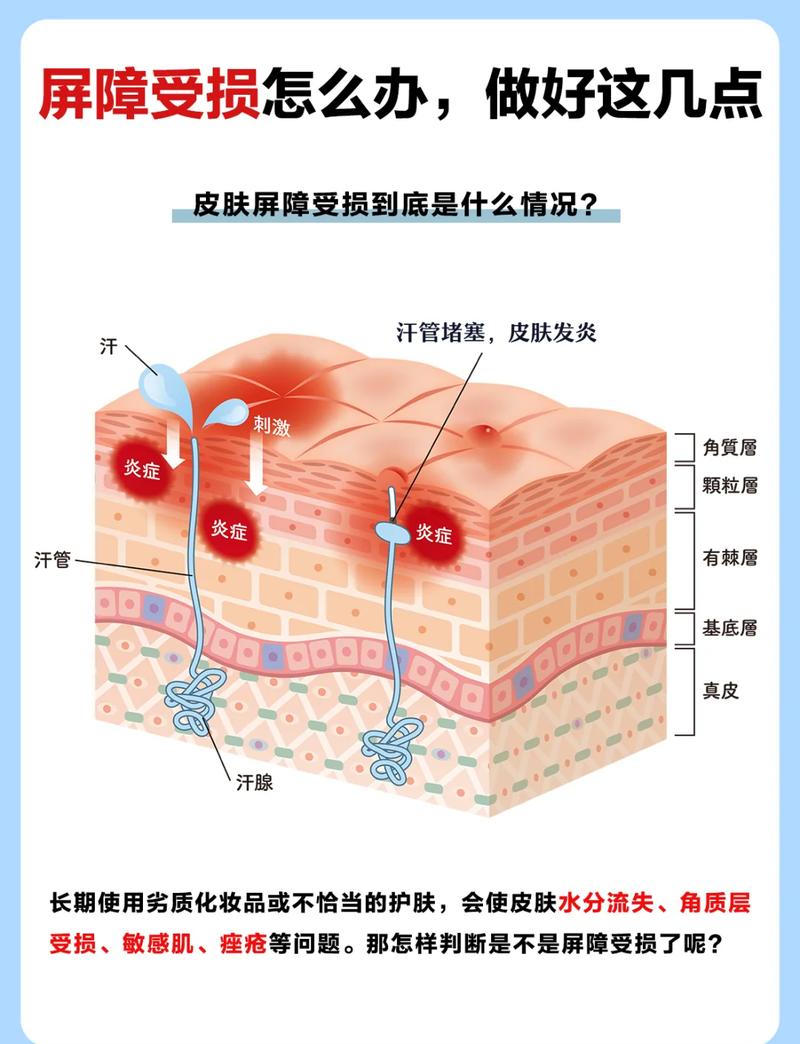 皮肤屏障受损对比健康肌肤示意图