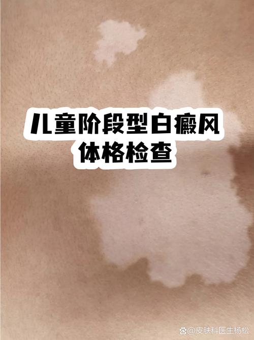 应用边界：什么情况下做了也白做
