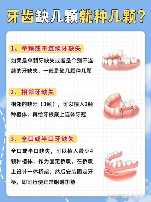 为什么要折腾一份牙齿记录?不就是几颗牙吗