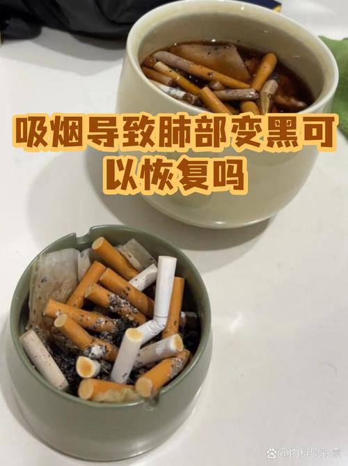 别等肺全黑了，才想起给规则补窟窿