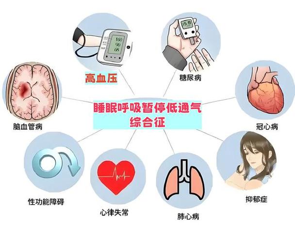 睡眠呼吸暂停事件中气流中断的家用监测示意图