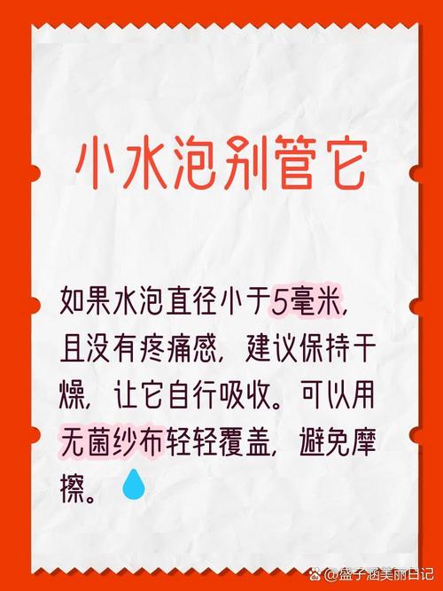 起了水泡，到底挑不挑破