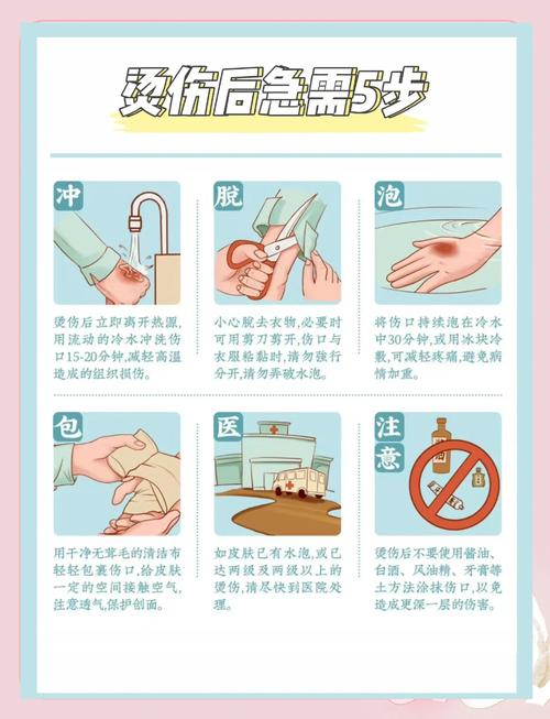 家庭轻度烫伤正确处理步骤图
