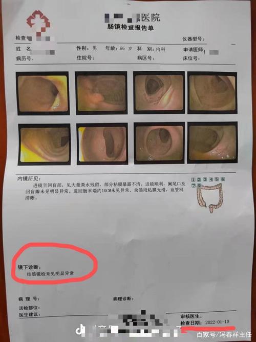 安装也有标准,错了三个月就复发