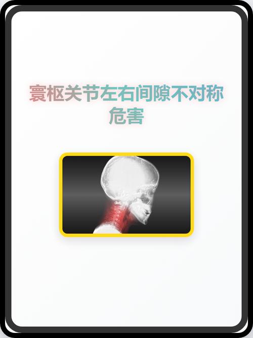 关节间隙，量产稳定性的隐形杀手