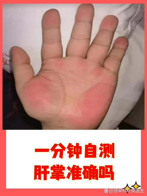 自测完,哪些情况要赶紧去医院?