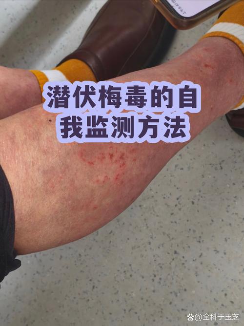 自我监测之后要注意什么？