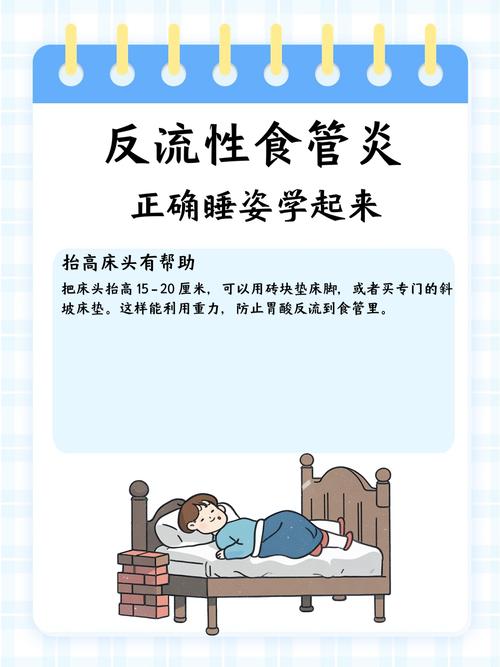 胃食管反流正确错误睡姿对比图