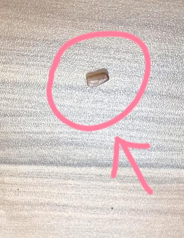 快递纸盒携带蟑螂卵鞘显微镜观察图