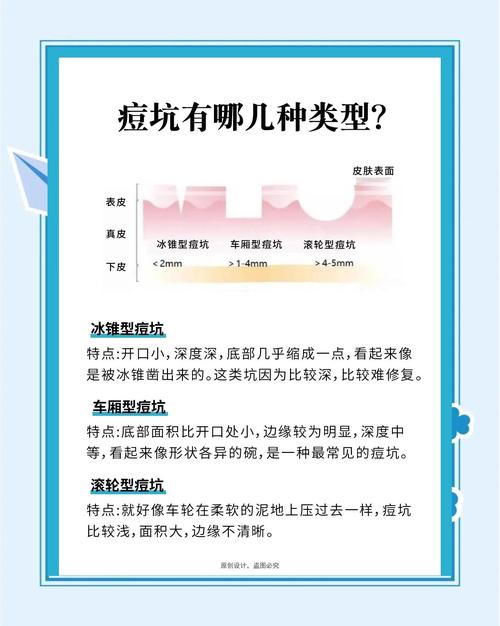 选型不能光看样本——几个你该知道的坑