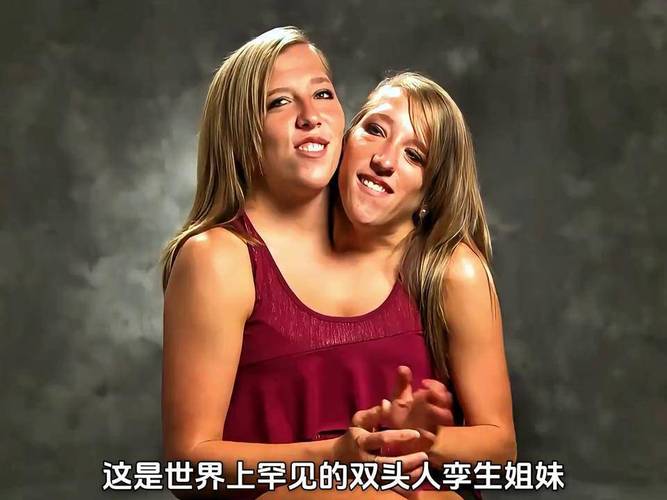 当每个人都能拥有自己的孪生体