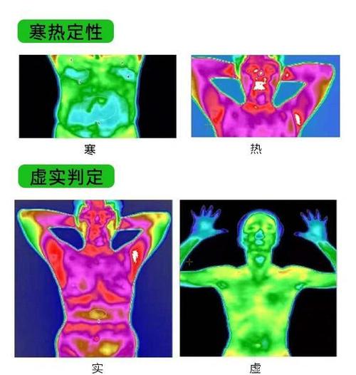 热成像不是测温,是看温度分布