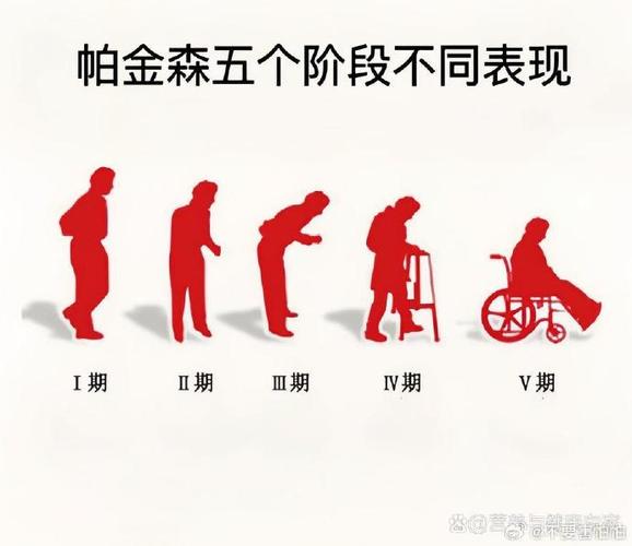 帕金森病患者正常与异常步态对比示意图