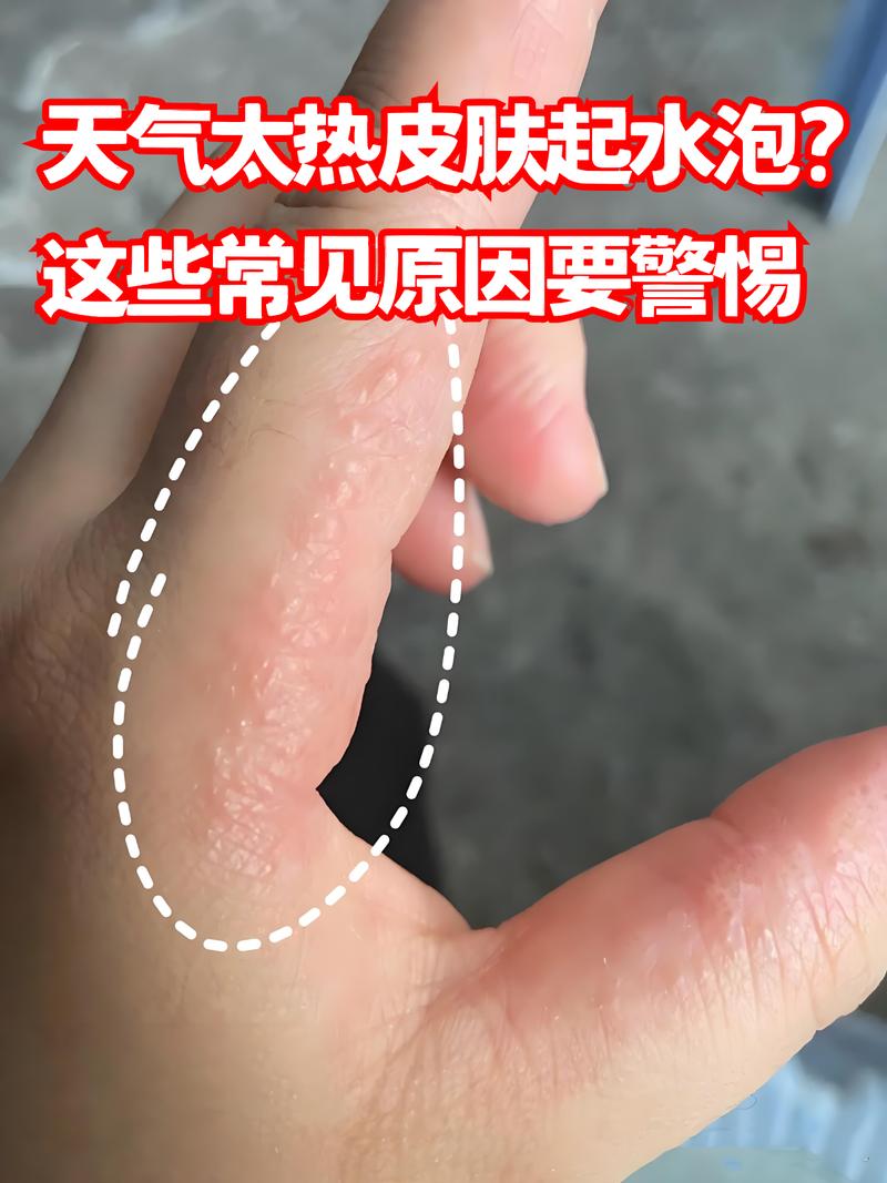 为什么不能用水泡？尤其热水