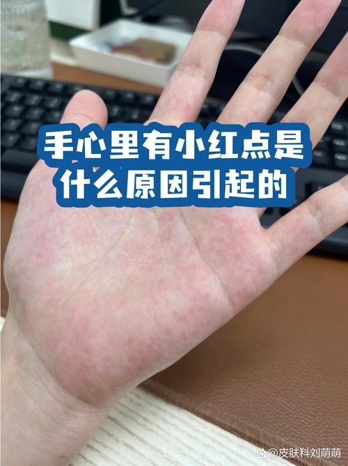 摊开手心就懂的约定