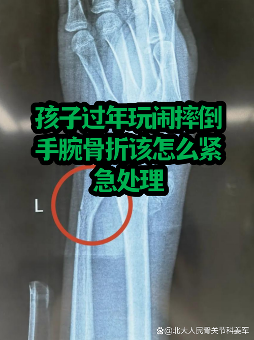 不小心断了，还有补救的路子吗