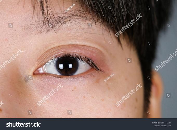 金雕 eye close-up showing retinal fovea