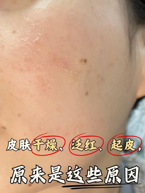 太阳光照射下草本干料褪色对比图