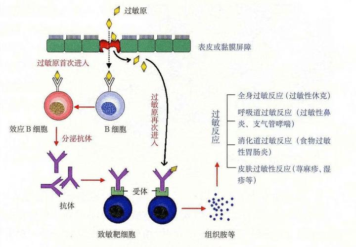 婴幼儿肠道免疫过敏反应原理示意图