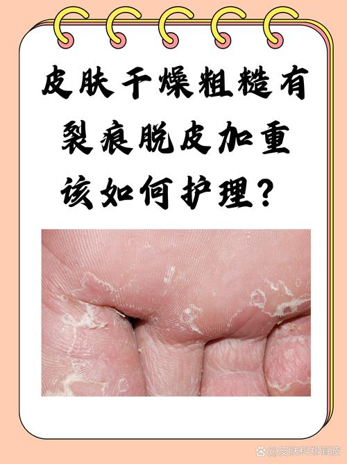 🛡️ 防裂与维护,最烦人的后遗症