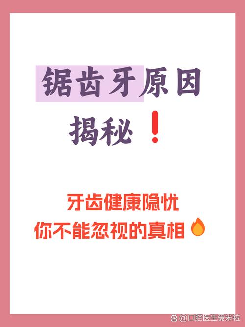 齿形决定一切？聊聊那些你忽视的细节