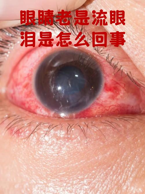 三、穿孔:都是眼泪