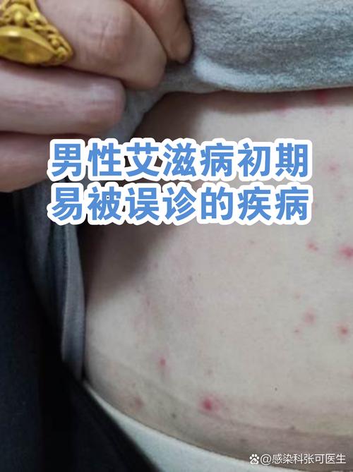 一些容易被误诊的奇怪表现