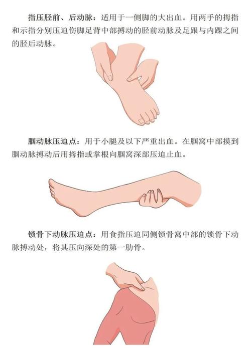 宠物四肢出血压迫止血位置示意图