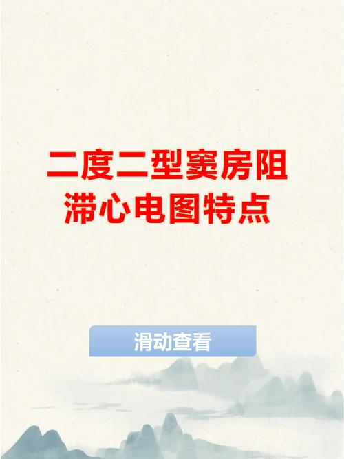 信号延迟：看不见的滞后害死整线