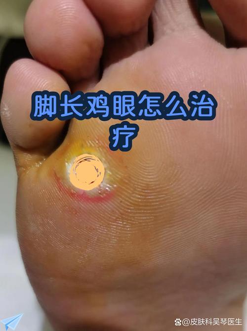 老茧踩过的石板路