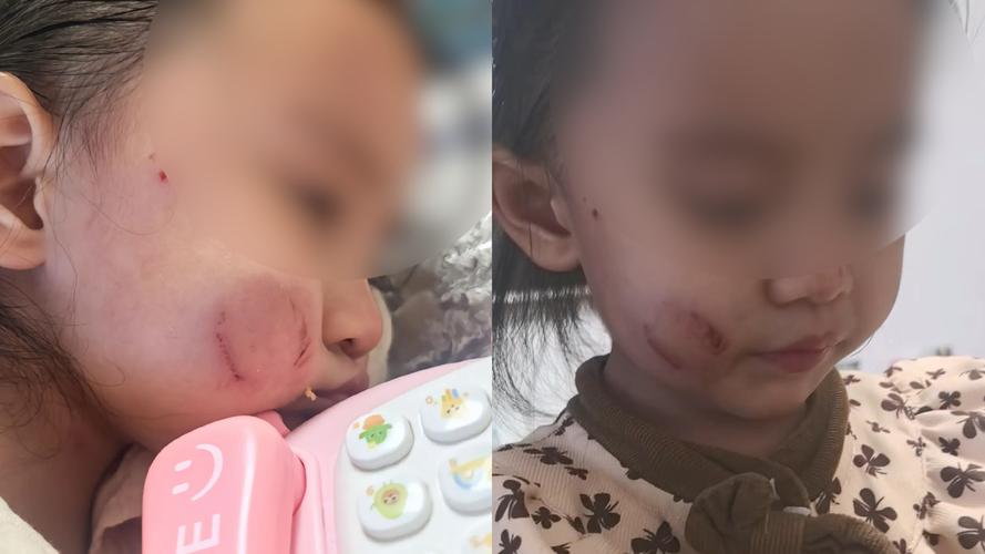 幼儿在托儿所咬小朋友的紧张场景