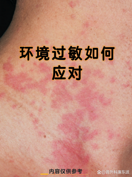 环境过敏?你以为的干净,其实全是坑