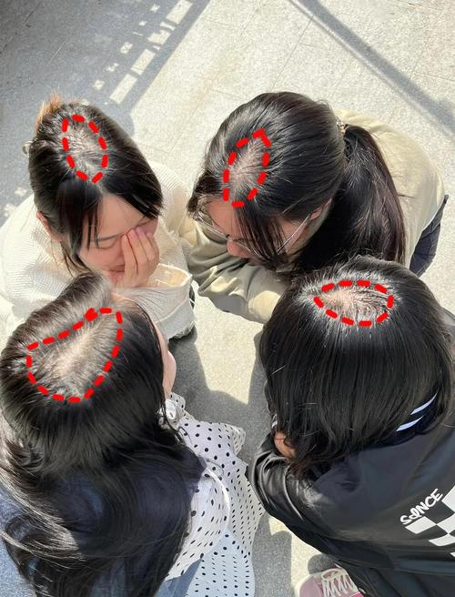 自然光下女性发缝宽度对比实拍图