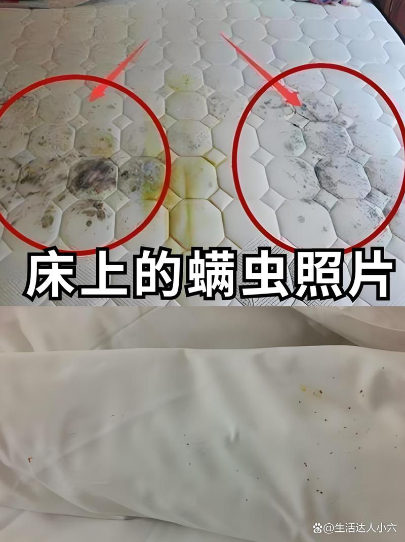 显微镜下布满尘螨和皮屑的床单纤维