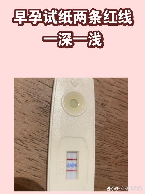 要划清的日常小惊喜就医红线