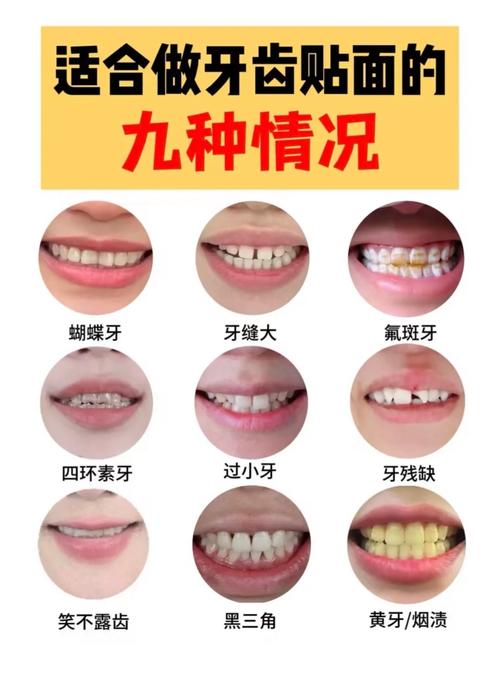 哪些人适合做牙齿记录