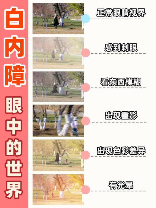 老年性白内障视物眩光对比图