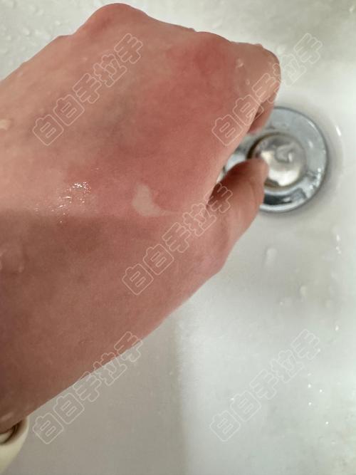一、敷完白一个度?那是泡发了