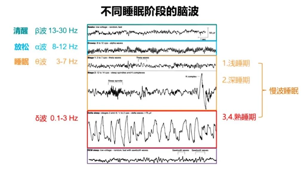 睡眠周期NREM与REM脑电波对比示意图