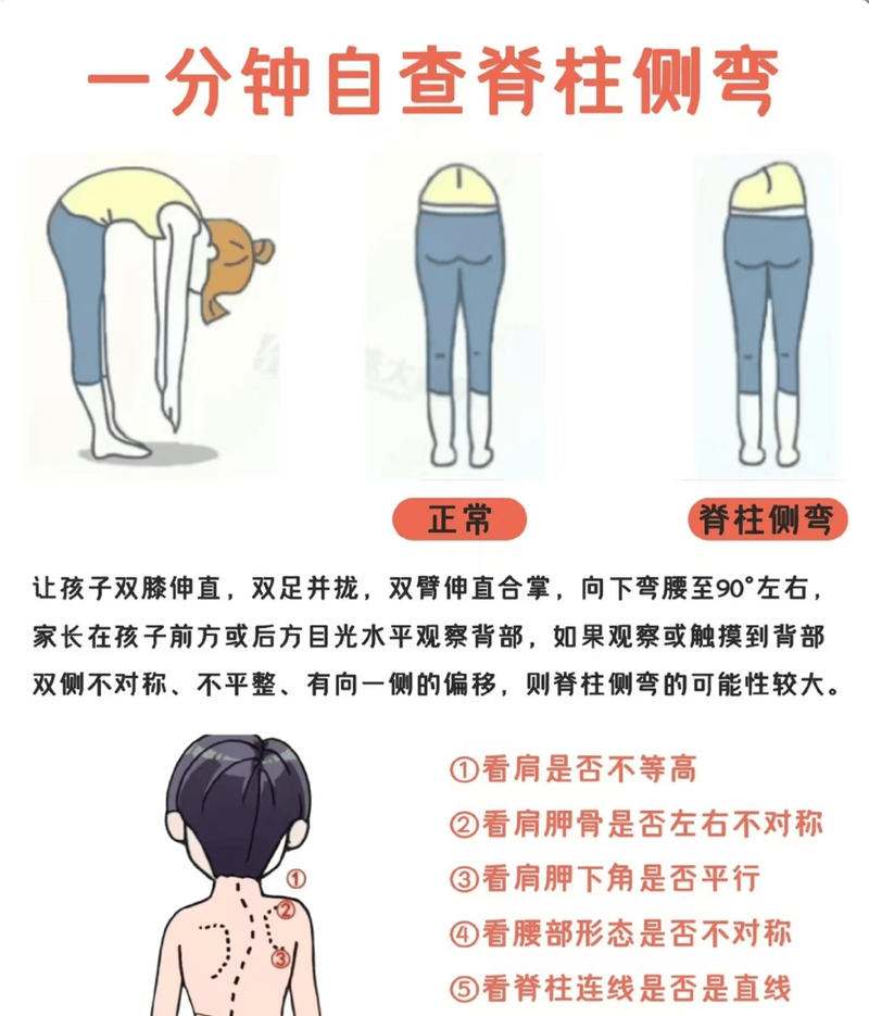 青少年脊柱侧弯弯腰筛查正确示范图