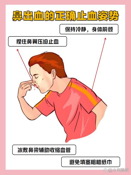 流鼻血错误仰头示意图