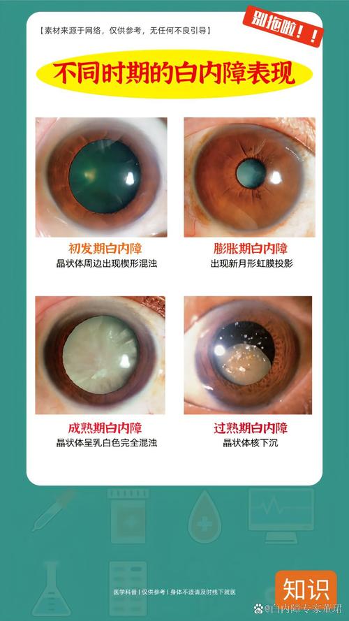老年性白内障视物颜色变化对比图