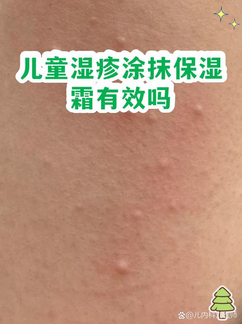 家长给湿疹宝宝洗完澡涂保湿霜实拍