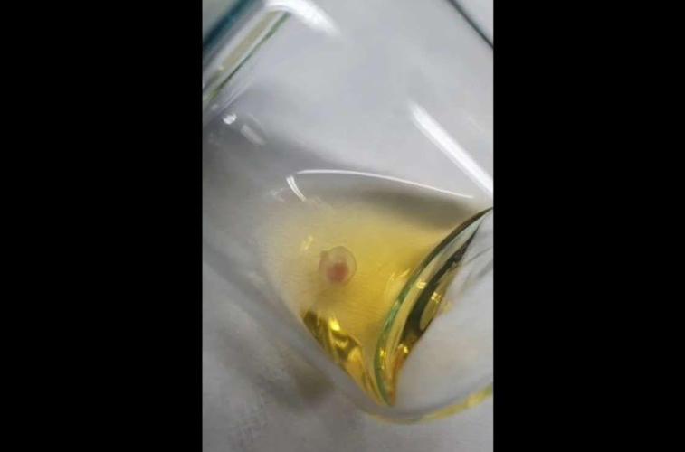 小鼠胚胎在人工机械子宫中发育的透明罐照片
