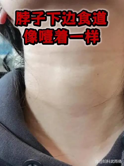 几个不起眼的细节，刚好卡着时效的脖子