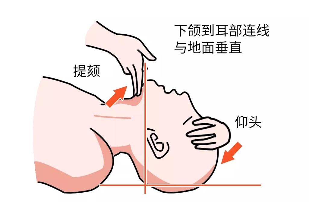 宠物心肺复苏气道开放操作演示图