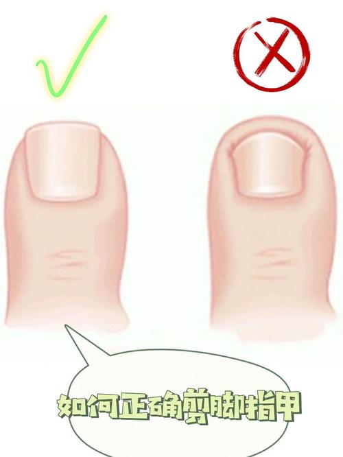 正确剪指甲留边长度示意图