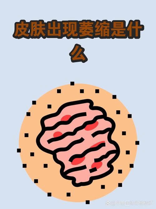 它离普通人其实很近