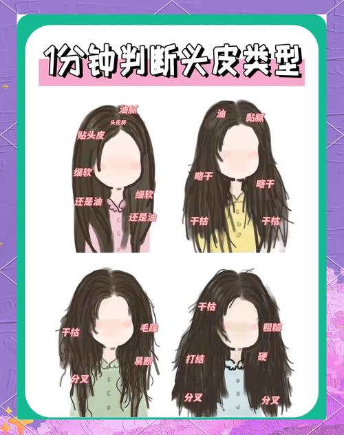 不同头皮肤质分类示意图
