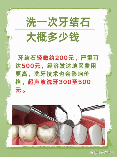 日常防牙结石，真不用花大价钱